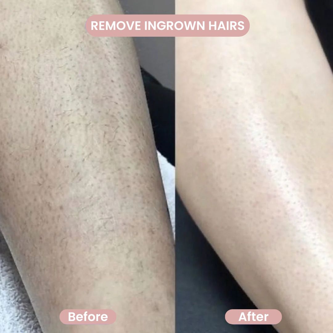 GlowShave™ 2-in-1 Women's Body Shaver: Gentle, Smooth, Irritation-Free Hair Removal