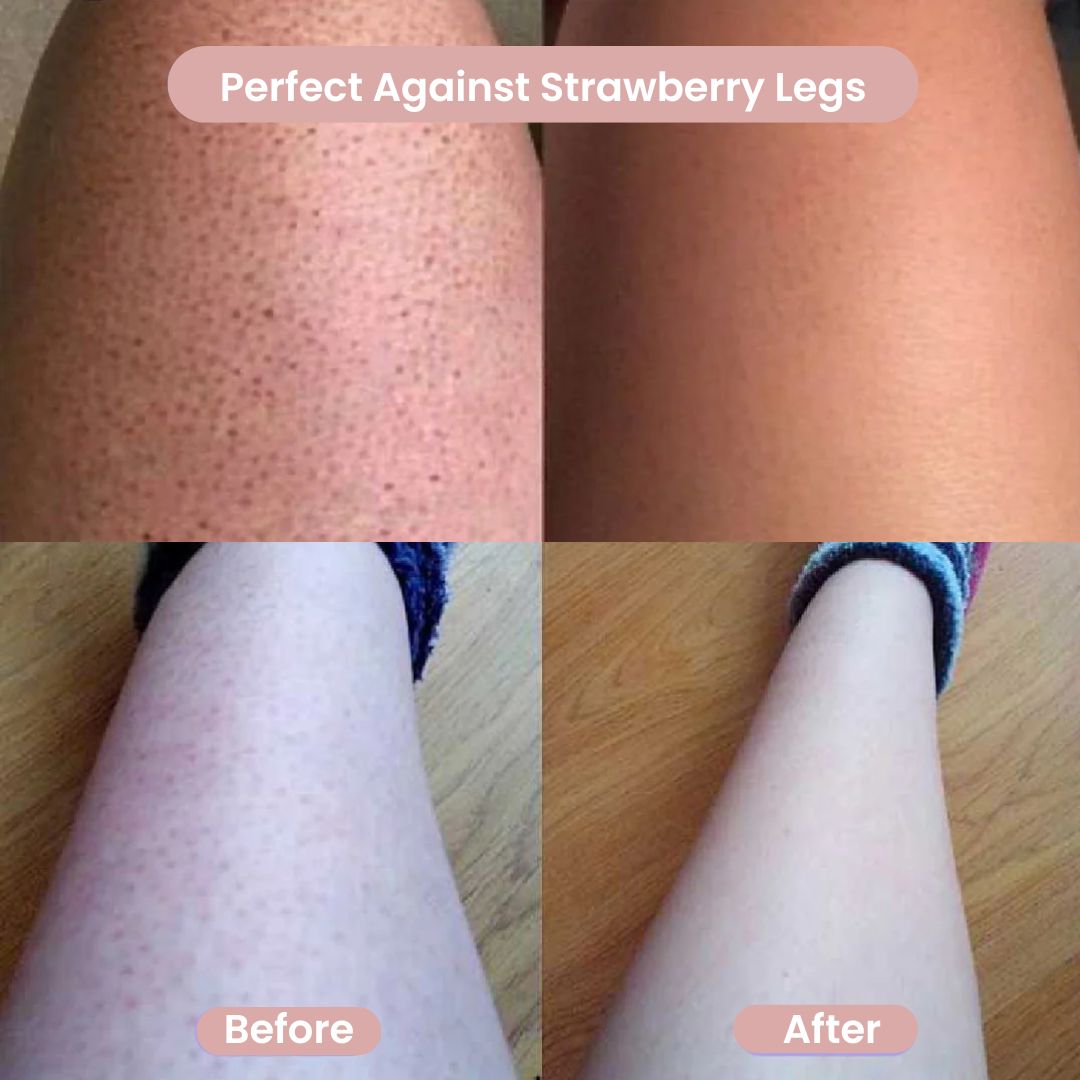 GlowShave™ 2-in-1 Women's Body Shaver: Gentle, Smooth, Irritation-Free Hair Removal